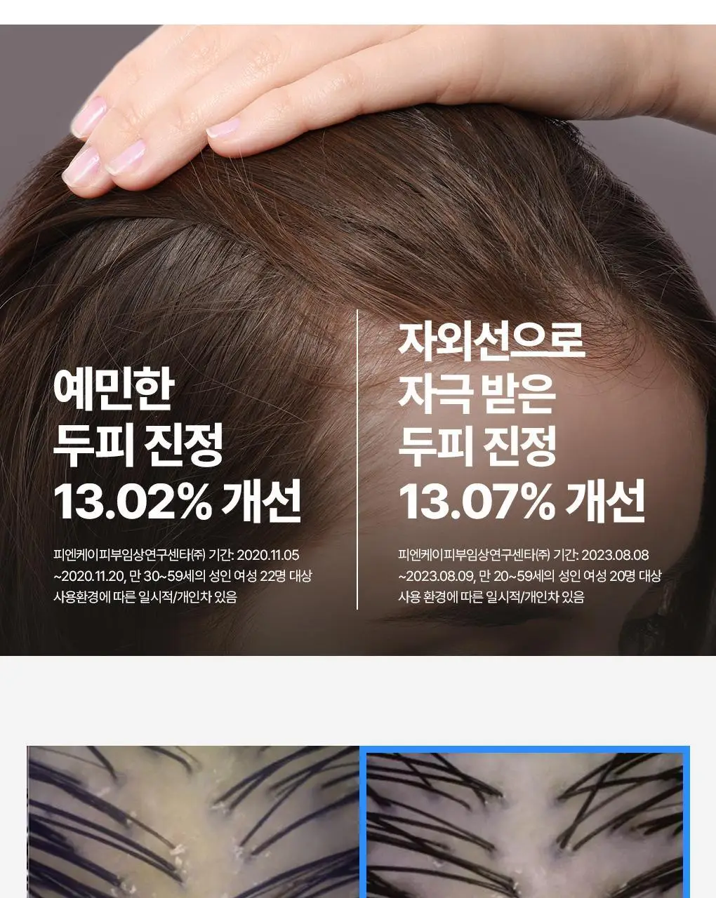 [지현우 PICK] 메디올 탈모케어 뉴트리션 에센스 120ml 상세페이지 11